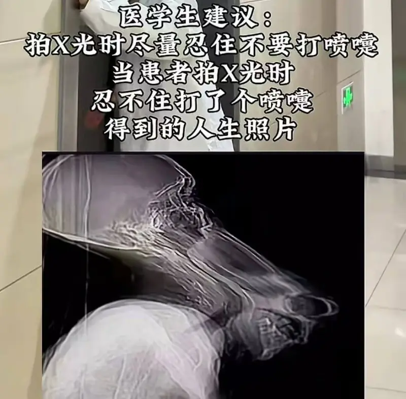 医学生建议：拍X光时尽量忍住不要打喷嚏当患者拍X光忍不住打了
