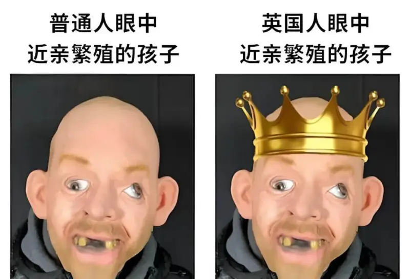 普通人眼中英国人眼中近亲繁殖的孩子近亲繁殖的孩子